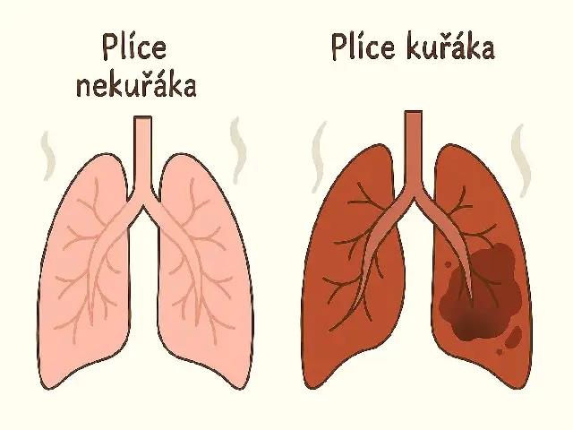 Kuřáci plíce 